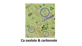 Ca oxalate & carbonate
 