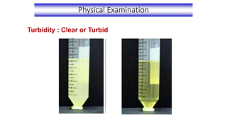 Physical Examination
Turbidity : Clear or Turbid
 