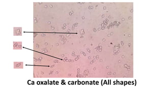 Ca oxalate & carbonate (All shapes)
 