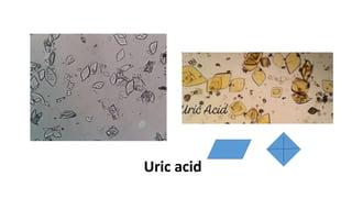 Uric acid
 