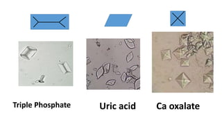 Uric acid Ca oxalate
Triple Phosphate
 
