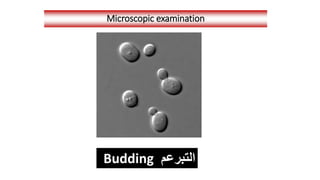 Microscopic examination
‫التبرعم‬
Budding
 