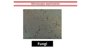 Microscopic examination
Fungi
 