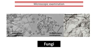 Microscopic examination
Fungi
 