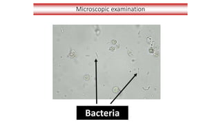 Microscopic examination
Bacteria
 