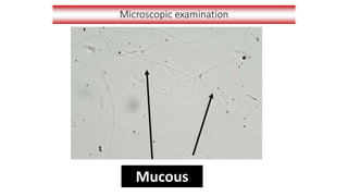 Microscopic examination
Mucous
 