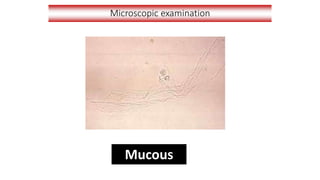 Microscopic examination
Mucous
 