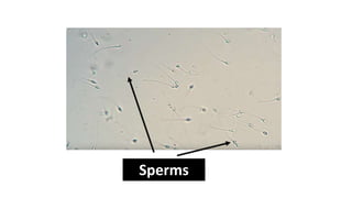 Sperms
 