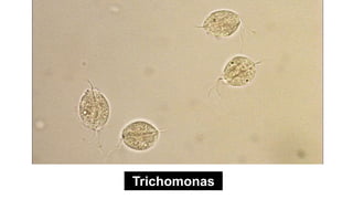Trichomonas
 