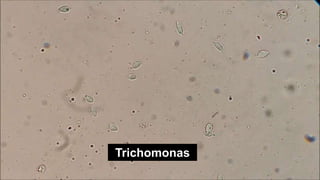 Trichomonas
 