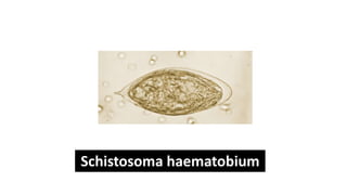 Schistosoma haematobium
 