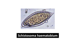 Schistosoma haematobium
 