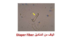 ‫المناديل‬ ‫من‬ ‫الياف‬
Diaper Fiber
 