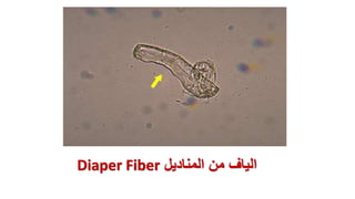 ‫المناديل‬ ‫من‬ ‫الياف‬
Diaper Fiber
 
