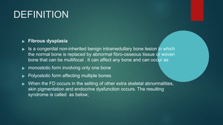 Bone U Comprehensive Overview of Fibrous Dysplasia: Diagnosis and Clinical ...