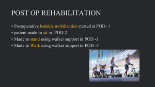 POST OP REHABILITATION
• Postoperative bedside mobilization started at POD- 1
• patient made to sit in POD-2
• Made to stand using walker support in POD -3
• Made to Walk using walker support in POD -4
 