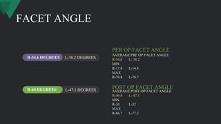 FACET ANGLE
L-38.2 DEGREES
L-47.1 DEGREES
R-34.6 DEGREES
R-40 DEGREES
AVERAGE PRE OP FACET ANGLE
R-34.6 L- 38.2
MIN
R-17.8 L-14.8
MAX
R-70.8 L-78.7
PER OP FACET ANGLE
AVERAGE POST-OP FACET ANGLE
R-40.8 L- 47.1
MIN
R-30 L-32
MAX
R-66.7 L-77.2
POST OP FACET ANGLE
 