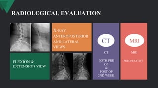 RADIOLOGICAL EVALUATION
X-RAY
ANTEROPOSTERIOR
AND LATERAL
VIEWS
FLEXION &
EXTENSION VIEW
CT MRI
BOTH PRE
OP
&
POST OP
2ND WEEK
CT
PREOPERATIVE
MRI
 