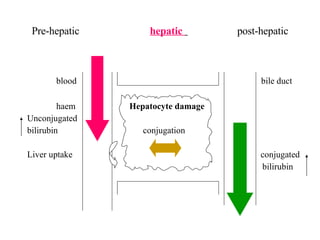 Pre-hepatic  hepatic  post-hepatic blood  bile duct haem  Hepatocyte damage Unconjugated bilirubin  conjugation Liver uptake  conjugated  bilirubin 