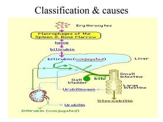 Classification & causes 