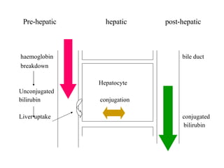 Pre-hepatic  hepatic  post-hepatic haemoglobin  bile duct breakdown   Hepatocyte Unconjugated bilirubin  conjugation Liver uptake  conjugated  bilirubin 