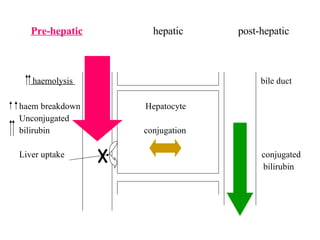 Pre-hepatic   hepatic  post-hepatic haemolysis  bile duct haem breakdown  Hepatocyte Unconjugated bilirubin  conjugation Liver uptake  conjugated  bilirubin 