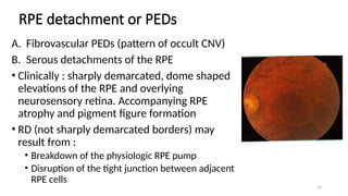 Wet Age Related Macular Degeneration and Choroidal Neovascular Membrane ...