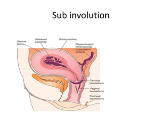 Sub involution
 