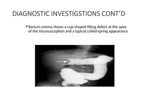 INTUSSUSCEPTION lecture for medical students.pptx