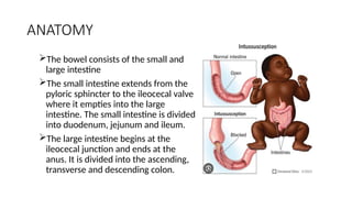 Intersection Intestinal INTUSSUSCEPTION lecture for medical students.pptx