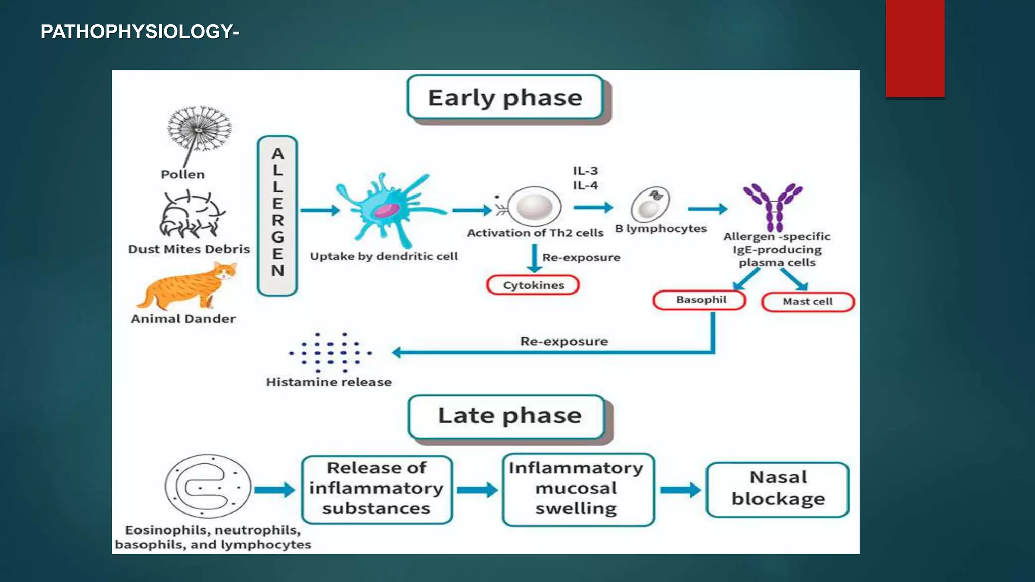 Allergic Rhinitis Pathophysiology Ncbi