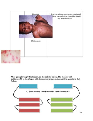Measles,

 Anyone with symptoms suggestive of
air-borne transmissible diseases should
not attend school.

Chickenpox

After going through this lesson, do the activity below. The teacher will
guide you fill in the shapes with the correct answers. Answer the questions that
follow.

1. What are the TWO KINDS OF TRANSMISSION?

186

 