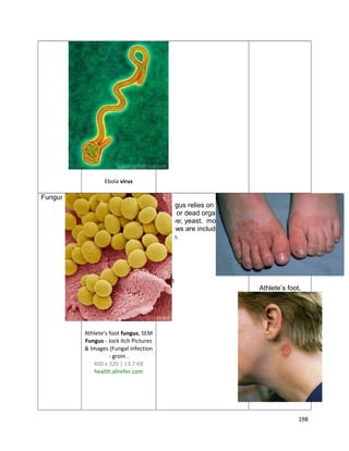 Ebola virus

Fungus
A fungus relies on other
living or dead organisms to
survive; yeast, molds, and
mildews are included in this
group.

Athlete’s foot,

Athlete's foot fungus, SEM
Fungus - Jock itch Pictures
& Images (Fungal infection
- groin .
400 x 320 | 13.7 KB
health.allrefer.com

198

 