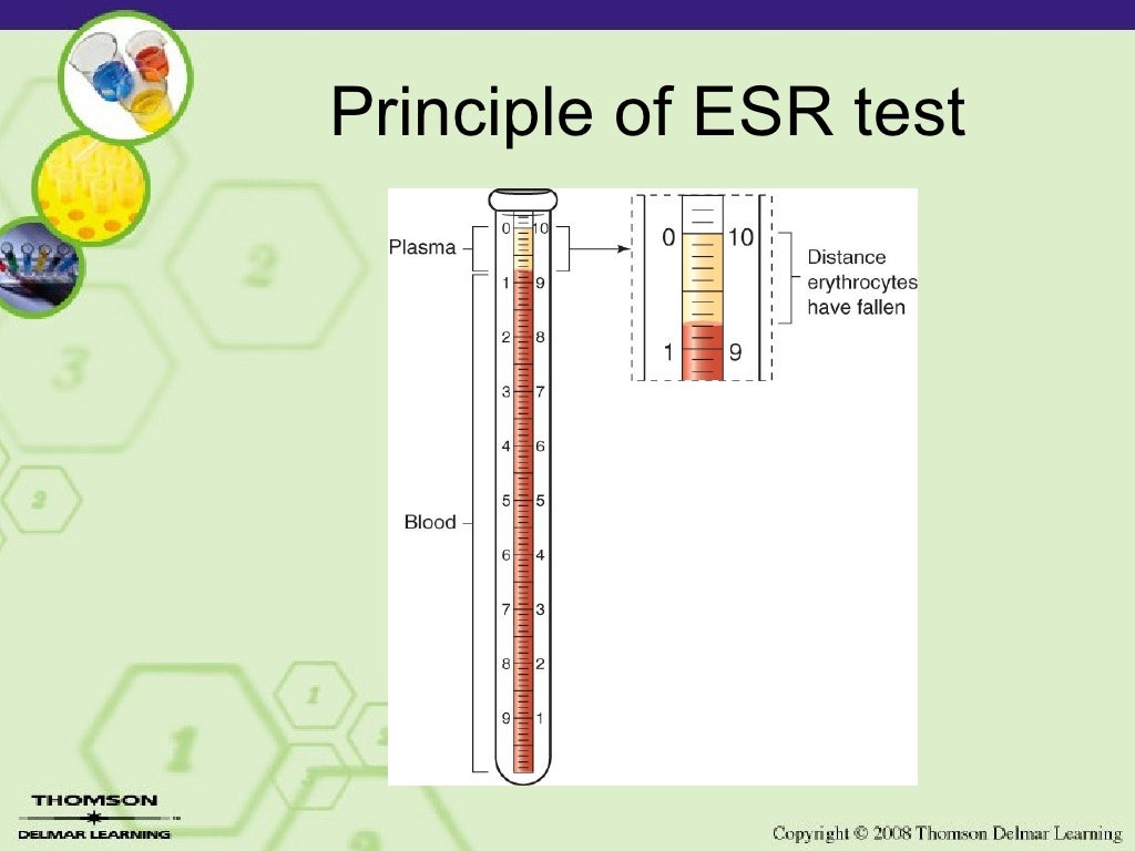 Copy (2) Of Lesson 2 12 Laboratory Esr