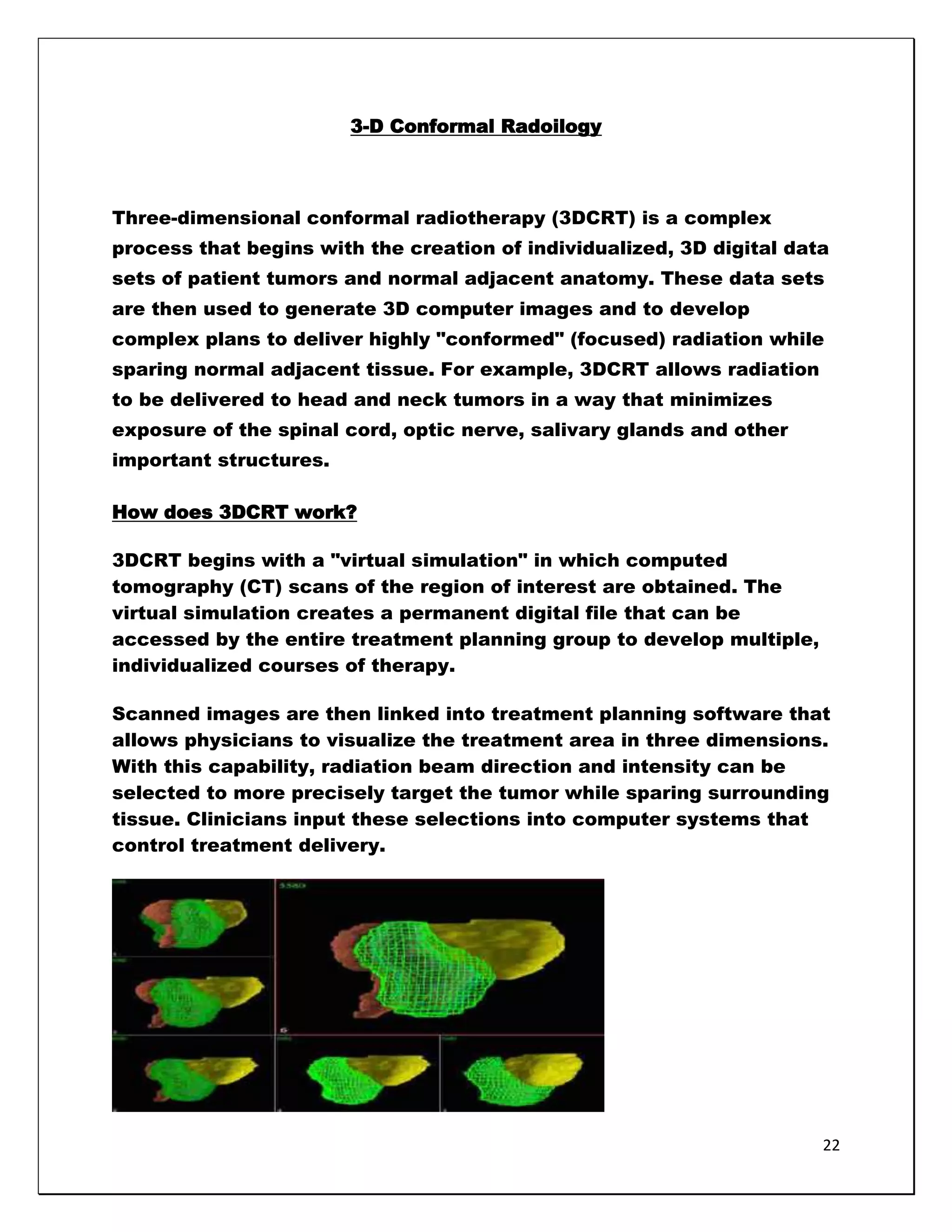 3-D Conformal Radoilogy



Three-dimensional conformal radiotherapy (3DCRT) is a complex
process that begins with the creation of individualized, 3D digital data
sets of patient tumors and normal adjacent anatomy. These data sets
are then used to generate 3D computer images and to develop
complex plans to deliver highly "conformed" (focused) radiation while
sparing normal adjacent tissue. For example, 3DCRT allows radiation
to be delivered to head and neck tumors in a way that minimizes
exposure of the spinal cord, optic nerve, salivary glands and other
important structures.

How does 3DCRT work?

3DCRT begins with a "virtual simulation" in which computed
tomography (CT) scans of the region of interest are obtained. The
virtual simulation creates a permanent digital file that can be
accessed by the entire treatment planning group to develop multiple,
individualized courses of therapy.

Scanned images are then linked into treatment planning software that
allows physicians to visualize the treatment area in three dimensions.
With this capability, radiation beam direction and intensity can be
selected to more precisely target the tumor while sparing surrounding
tissue. Clinicians input these selections into computer systems that
control treatment delivery.




                                                                       22
 