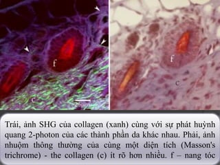 Trái, ảnh SHG của collagen (xanh) cùng với sự phát huỳnh
quang 2-photon của các thành phần da khác nhau. Phải, ảnh
nhuộm thông thường của cùng một diện tích (Masson's
trichrome) - the collagen (c) ít rõ hơn nhiều. f – nang tóc
 