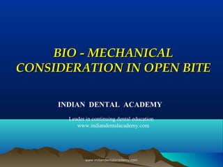 BIO - MECHANICAL
CONSIDERATION IN OPEN BITE
INDIAN DENTAL ACADEMY
Leader in continuing dental education
www.indiandentalacademy.com

www.indiandentalacademy.com

 