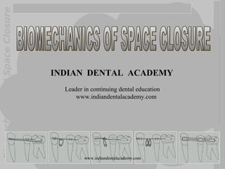 Biomechanics of Space Closure

INDIAN DENTAL ACADEMY
Leader in continuing dental education
www.indiandentalacademy.com

www.indiandentalacademy.com

 