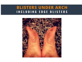 ENGO Blister Patch Placement Masterclass
