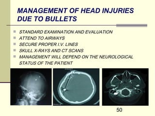 Skull Potential Injuries CRANIO CEREBRAL INJURIES FOR MEDICAL STUDENTS | PPT