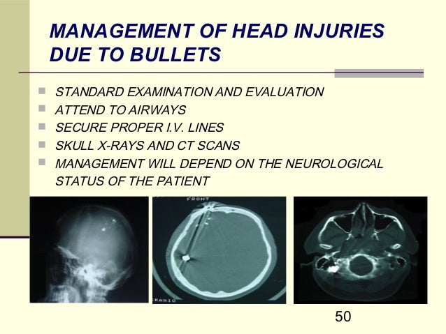 Brain enhancer pill image 1