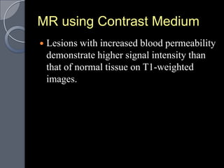 MR using Contrast Medium
   Lesions with increased blood permeability
    demonstrate higher signal intensity than
    that of normal tissue on T1-weighted
    images.
 