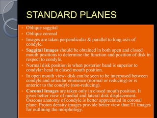 STANDARD PLANES
   Oblique saggital
   Oblique coronal
   Images are taken perpendicular & parallel to long axis of
    condyle.
   Saggital Images should be obtained in both open and closed
    mouth positions to determine the function and position of disk in
    respect to condyle.
   Normal disk position is when posterior band is superior to
    condylar head in closed mouth position.
   In open mouth view- disk can be seen to be interposed between
    condyle and articular eminence (normal or reducing) or is
    anterior to the condyle (non-reducing).
   Coronal Images are taken only in closed mouth position. It
    gives better view of medial and lateral disk displacement.
    Osseous anatomy of condyle is better appreciated in coronal
    plane. Proton density images provide better view than T1 images
    for outlining the morphology.
 