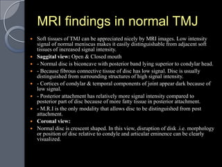 MRI findings in normal TMJ
   Soft tissues of TMJ can be appreciated nicely by MRI images. Low intensity
    signal of normal meniscus makes it easily distinguishable from adjacent soft
    tissues of increased signal intensity.
   Saggital view: Open & Closed mouth
   - Normal disc is biconcave with posterior band lying superior to condylar head.
   - Because fibrous connective tissue of disc has low signal. Disc is usually
    distinguished from surrounding structures of high signal intensity.
   - Cortices of condylar & temporal components of joint appear dark because of
    low signal.
   - Posterior attachment has relatively more signal intensity compared to
    posterior part of disc because of more fatty tissue in posterior attachment.
   - M.R.I is the only modality that allows disc to be distinguished from post
    attachment.
   Coronal view:
   Normal disc is crescent shaped. In this view, disruption of disk .i.e. morphology
    or position of disc relative to condyle and articular eminence can be clearly
    visualized.
 