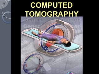 COMPUTED
TOMOGRAPHY
 