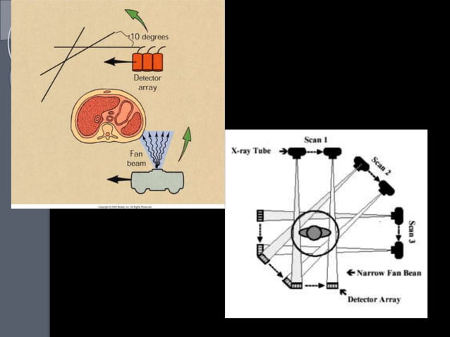 Basics of CT & MRI | PPTX
