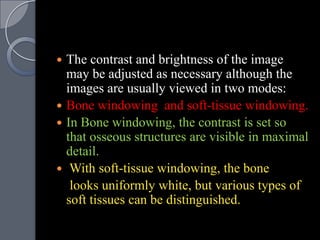  The contrast and brightness of the image
  may be adjusted as necessary although the
  images are usually viewed in two modes:
 Bone windowing and soft-tissue windowing.
 In Bone windowing, the contrast is set so
  that osseous structures are visible in maximal
  detail.
 With soft-tissue windowing, the bone
   looks uniformly white, but various types of
  soft tissues can be distinguished.
 
