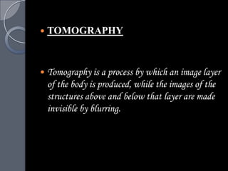    TOMOGRAPHY



   Tomography is a process by which an image layer
    of the body is produced, while the images of the
    structures above and below that layer are made
    invisible by blurring.
 