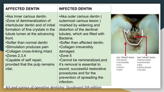 Dentin | PPTX
