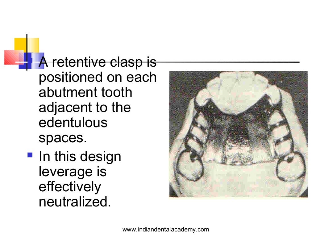 Designing in removable partial dentures /certified fixed orthodontic